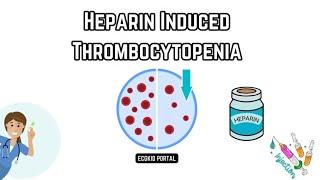 🩺 Understanding Heparin-Induced Thrombocytopenia HIT Causes pathophysiology and Treatment 🩺