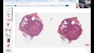 Avi Bitterman Dermpath Lecture 3