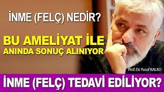 İnme Felç Tedavi Edilebilir... İşte Detaylar...   Prof. Dr. Yusuf KALKO