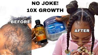 HOW I USE VASELINE AND JAMAICAN BLACK CASTOR OIL FOR MASSIVE HAIR GROWTH April 15 2024