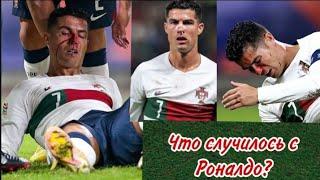 СЕРЬЁЗНАЯ ТРАВМА? Как Роналдо сломал нос из-за матча с Чехией.Полное видео