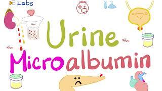 Microalbumin in the Urine Microalbuminuria - Diabetes Mellitus & Kidney Disease - Nephrology Labs