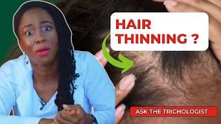 6 Major Reasons Why Your Hair Is Thinning  Ask The Trichologist Ep.48 #hairloss #haircare