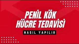 Penil Kök Hücre Tedavisi Sertleşme Sorununda Nasıl Yapılır ?