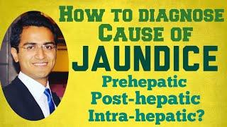 Jaundice Diagnostic Workup - Causes Symptoms & Treatment