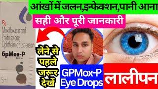 gpmox-p eye drops in hindi  moxifloxacin eye drops  moxifloxacin eye drops ip  moxifloxacin 400mg