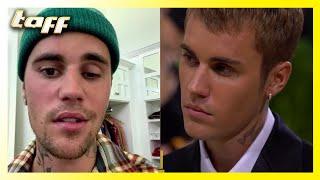 Justin Bieber leidet an ziemlich ernster Gesichtslähmung  taff  ProSieben