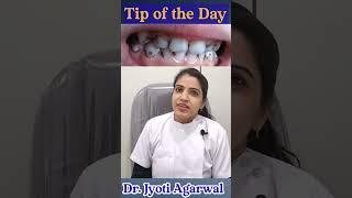 Tip of the day #18  how to get rid of black stains on teeth caused by multivitamins