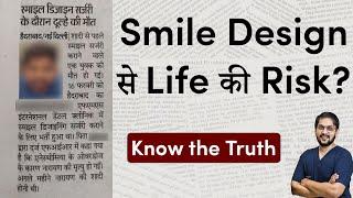 Risk & Side Effects of Smile Design  Reason for Death in Smile Design  Dr Ankit Khasgiwala Indore