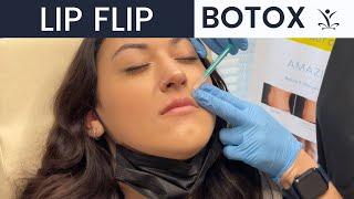 BOTOX Lip Flip Injections