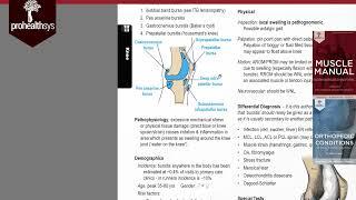 Knee Bursitis  swelling Dr Vizniak