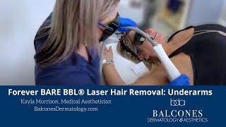 Forever BARE BBL® Laser Hair Removal for the Underarms  Austin Texas  Ph 512-459-4869