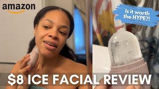 Ice Face Roller with WATER ALOE to Heal Acne and Scars  TWO MONTHS LATER