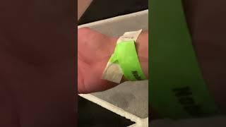 Wristband removal tutorial.  30+ years of experience.