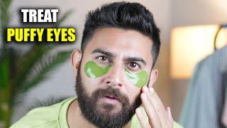 HOW TO TREAT PUFFY EYES  DARK CIRCLES  TIRED EYES  Under Eye Bags  Under Eye Patches  DSBOSSKO