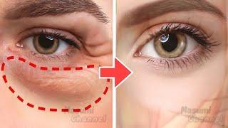 Anti-Aging Face Exercises For Eye Bags Dark Circles Under Eyes Eye Wrinkles  No Surgery