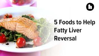 5 Foods to Help Fatty Liver Reversal  Healthline