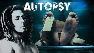 Autopsy Podcast What Really Happened To Bob Marley?