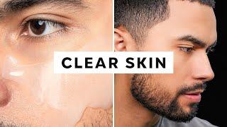 How To Get Clear Skin Only 3 Steps