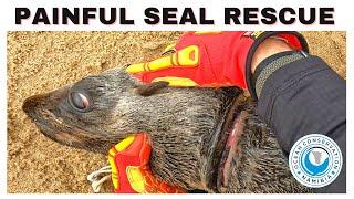 Painful Seal Rescue