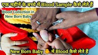 New Born Baby में Blood sample कैसे ले  छोटे बच्चों में Blood Sample कैसे निकाले in one  month baby