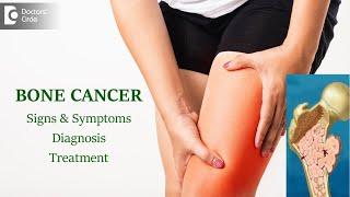Bone Cancer Types Causes Symptoms Diagnosis  Bone Marrow-Dr. Mangesh P Kamath  Doctors Circle