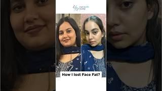 Lost FACE FAT  9kg weight loss  MyHealthBuddy