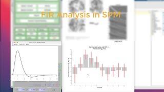 Finite Impulse Response FIR Analysis in SPM