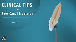 Root Canal Treatment  Clinical tips  Part 1