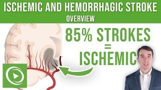 Overview of Ischemic and Hemorrhagic Stroke  Lecturio