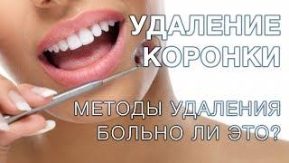 Зубные коронки  Как снимают зубные коронки?