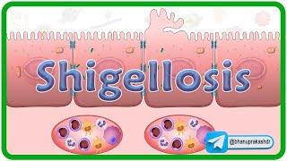 Shigellosis Microbiology  Animation  Pathogenesis Clinical manifestations Diagnosis & Treatment