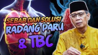 RADANG PARUTBC SEBAB DAN SOLUSINYA