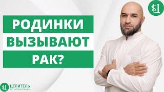 Почему появляются родинки?  РОДИНКИ ОПАСНЫ?  Удалять или нет?