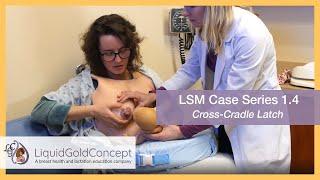 Case 1.4 Cross-Cradle Latch  Lactation Simulation Model Case Series