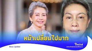 เปิดหน้าใหม่ ‘โย ทัศน์วรรณ’ หลังตัดสินใจศัลยกรรมใบหน้าThainews - ไทยนิวส์ENT-16 -PP