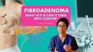 Understanding Fibroadenomas Can it turn to cancer? - with Dr Tasha