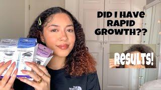 RAPIDLASH AND RAPIDBROW REVIEW DO THEY WORK? FT Before and Afters #Gifted