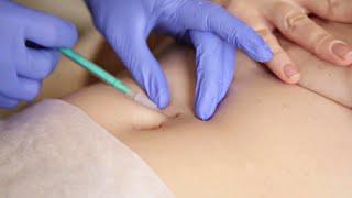 Needle Poke and Belly Button Navel piercing procedure  Navel Play