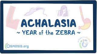 Achalasia Year of the Zebra