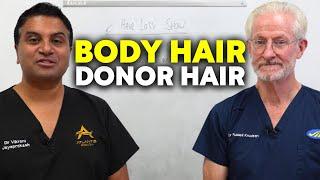 Body Hair As Donor Hair  The Hair Loss Show