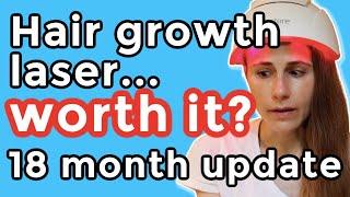 iRestore hair growth laser 18 month update. Is it worth it? Dr Dray