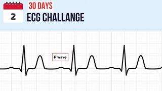 Day 2 - The P Wave on EKG  Join the 30-Day ECG Challenge Now