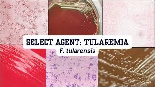 Morphology Moments - Tularemia