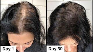 Powerful Hair Growth Serum For Extreme Hair Growth