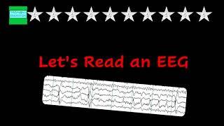 Lets Read an EEG