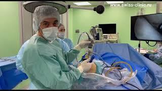 Артроскопия видео из операционной