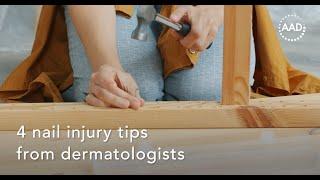 4 nail injury tips from dermatologists