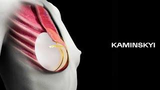 Anatomical implants under the muscle  KAMINSKYI