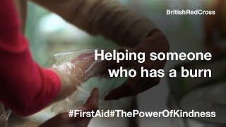 First Aid  Helping someone who has a burn  British Red Cross